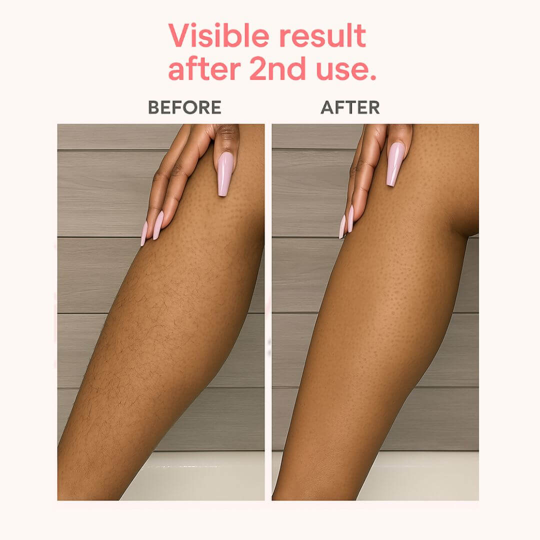 IPL Hair Removal – Visible Results in 2 Uses Skin-Friendly Clinically Tested For Face Bikini